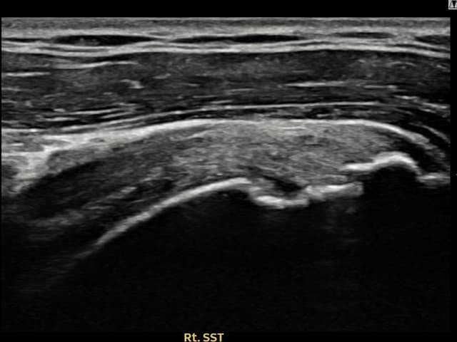 ケース 7 施術後