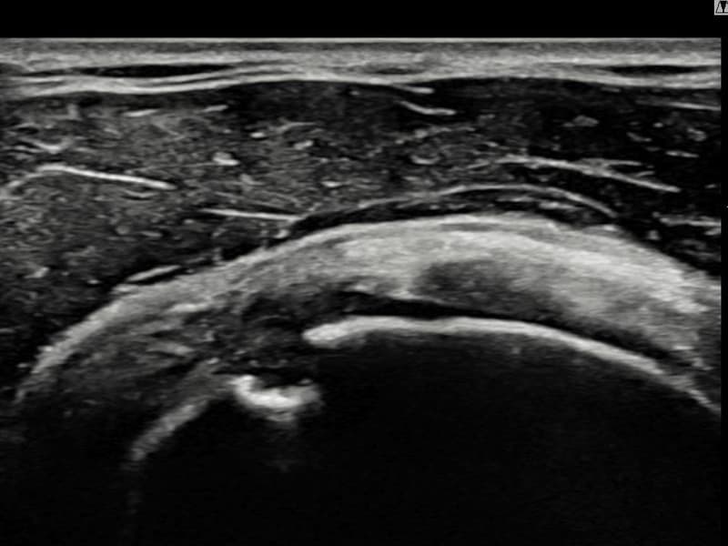 症例 No.7 — 施術前