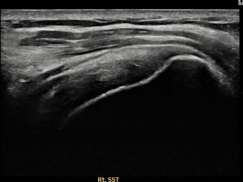 病例No.8 — 术前