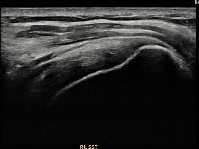 ケース 8 施術前