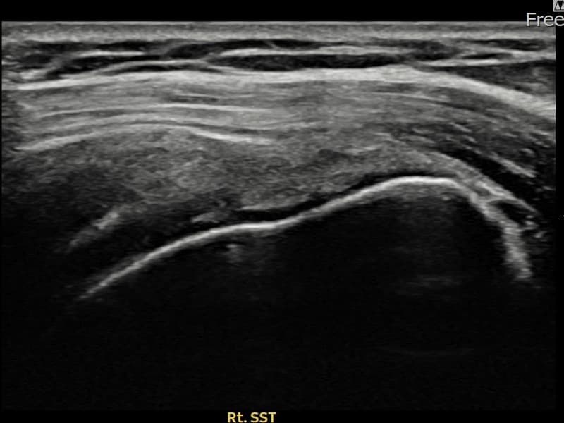 症例 No.9 — 施術後