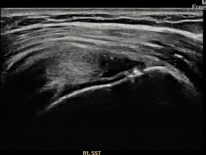 症例 No.9 — 施術前