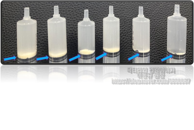주사기를 보면 하얗게 침전된 것이 분쇄된 석회가 가라앉은 것입니다.
