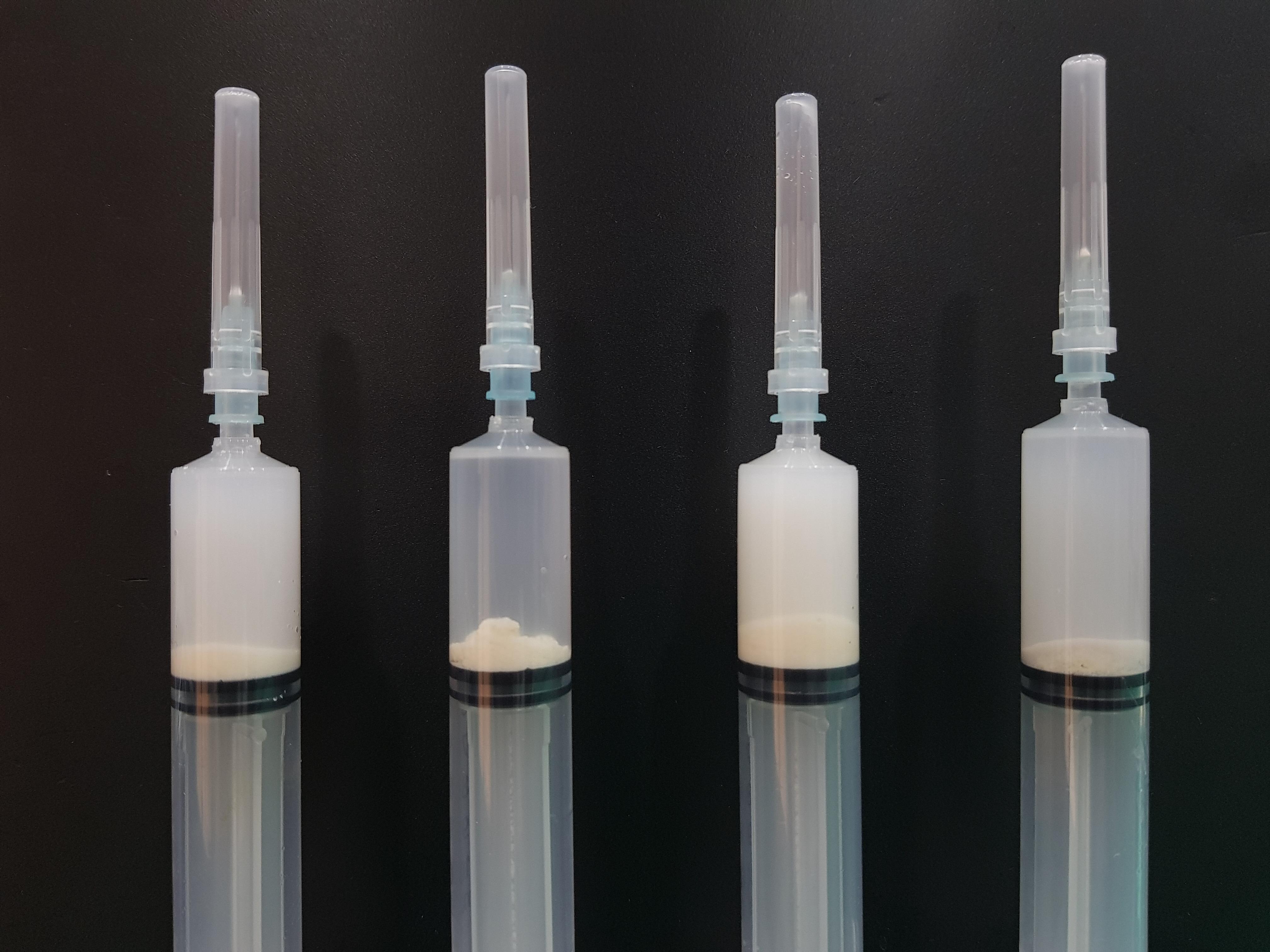 석회분쇄흡입술로 제거된 석회