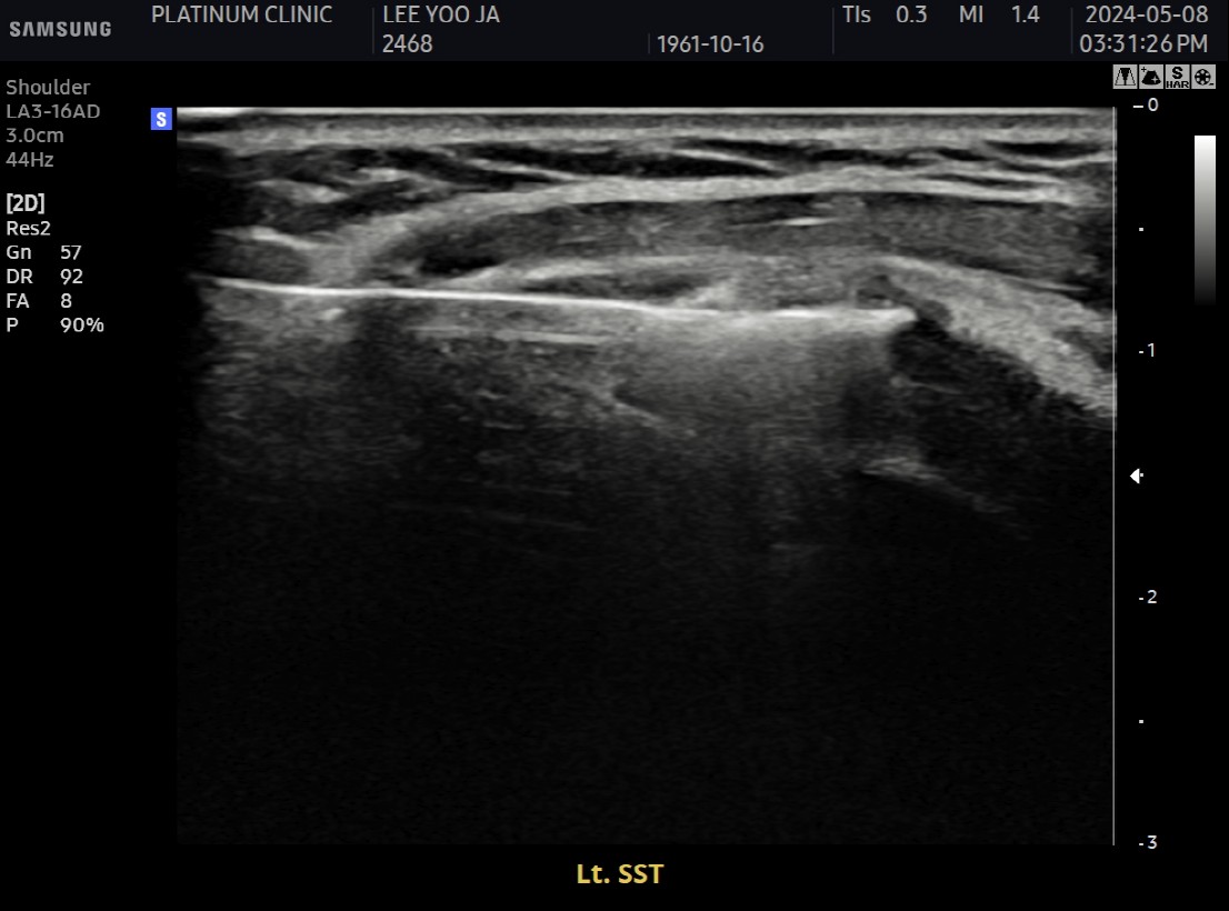 전용 분쇄 기구