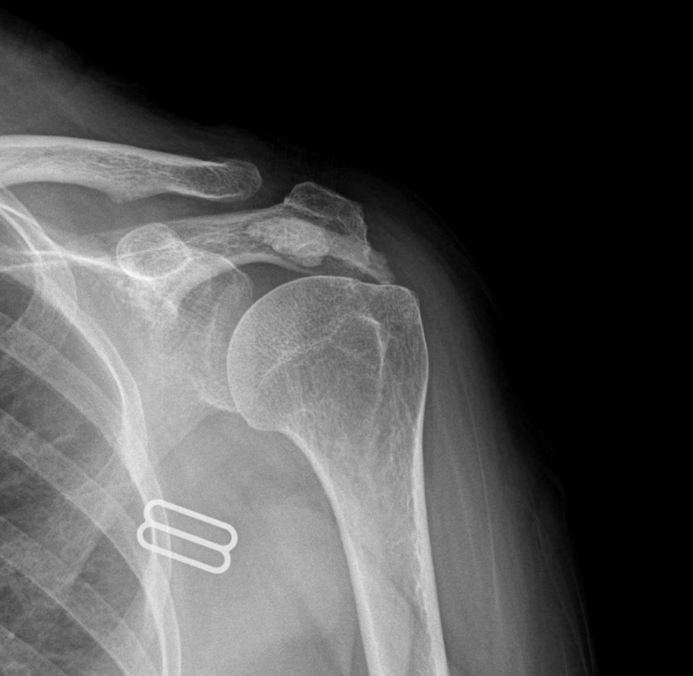 임산부 환자 시술 전 초음파