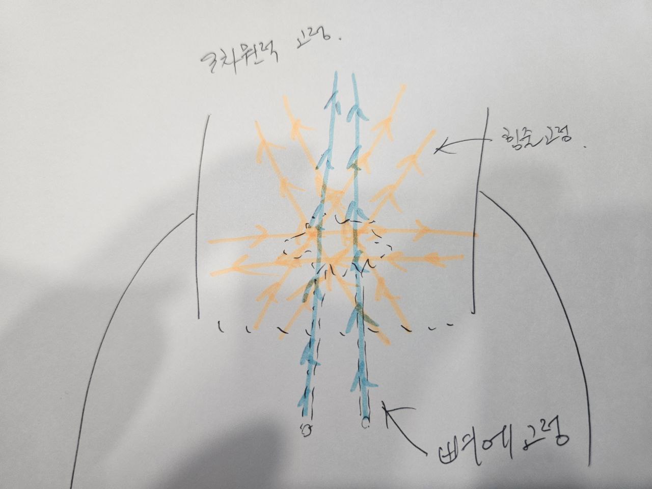 일반 vs 플래티넘 축소봉합술 비교